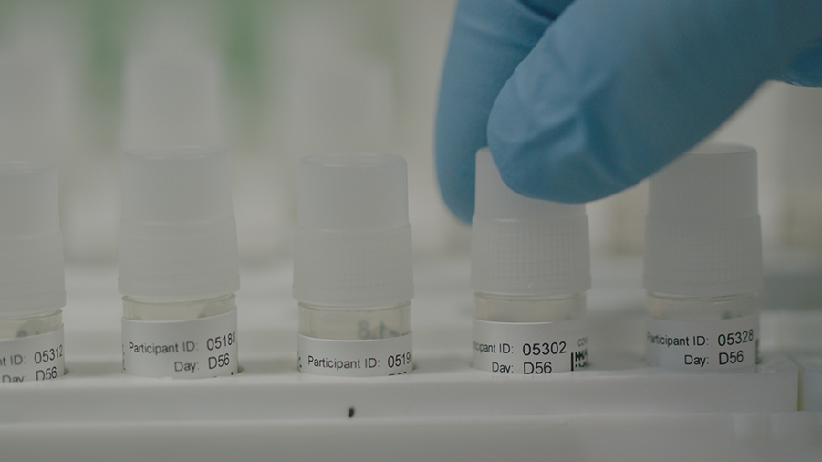 Clinical trial samples being prepared for testing in the laboratory at the University of Oxford’s Jenner Institute, UK.