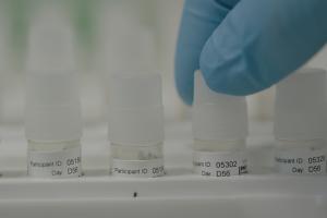 Clinical trial samples being prepared for testing in the laboratory at the University of Oxford’s Jenner Institute, UK.