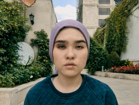 A young woman stares into the camera with a black eye.