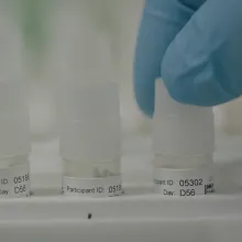 Clinical trial samples being prepared for testing in the laboratory at the University of Oxford’s Jenner Institute, UK.